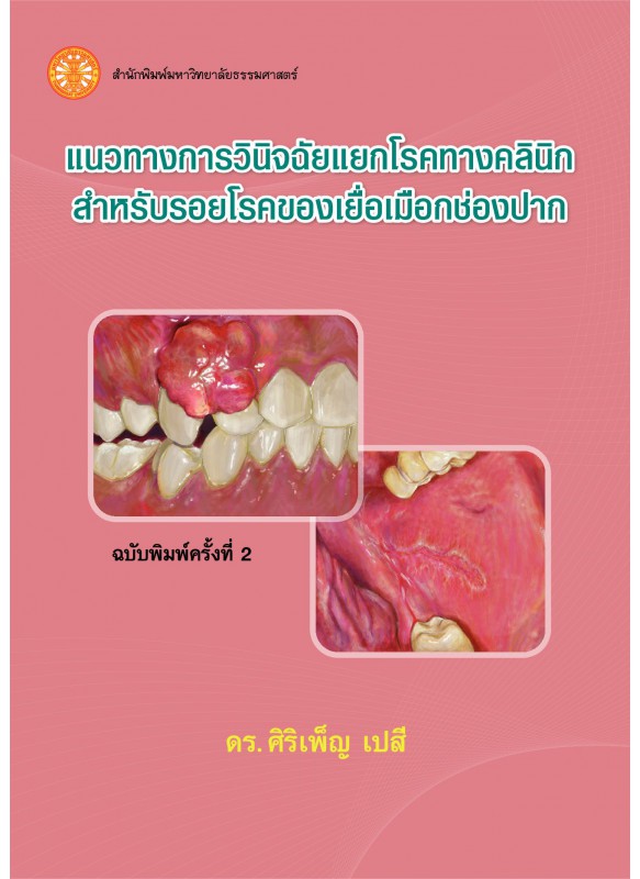 แนวทางการวินิจฉัยแยกโรคทางคลินิก สำหรับรอยโรคของเยื่อเมือกช่องปาก  ฉพ.2