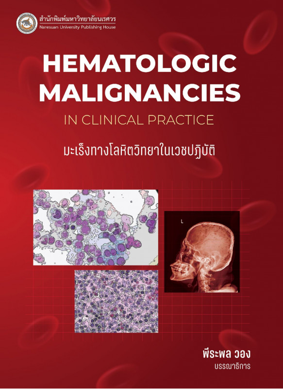 มะเร็งทางโลหิตวิทยาในเวชปฏิบัติ