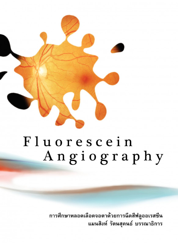 การศึกษาหลอดเลือดจอตาด้วยการฉีดสีฟลูออเรสซีน Fluorescein Angiography
