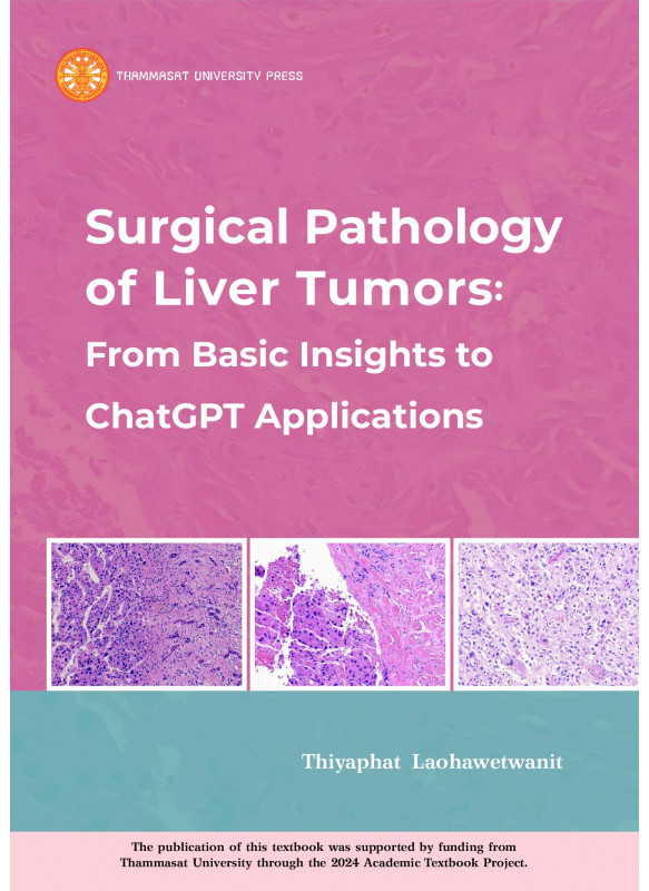 Surgical Pathology of Liver Tumors: From Basic Insights to ChatGPT Applications