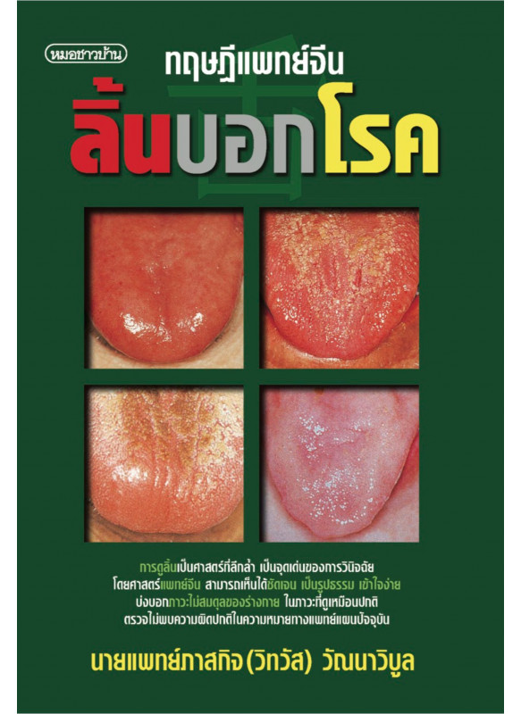 ลิ้นบอกโรค ลิ้นบอกโรค