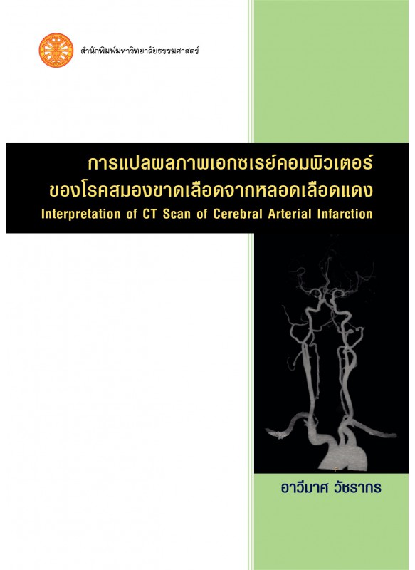 การแปลผลภาพเอกซเรย์คอมพิวเตอร์ของโรคสมองขาดเลือดจากหลอดเลือดแดง