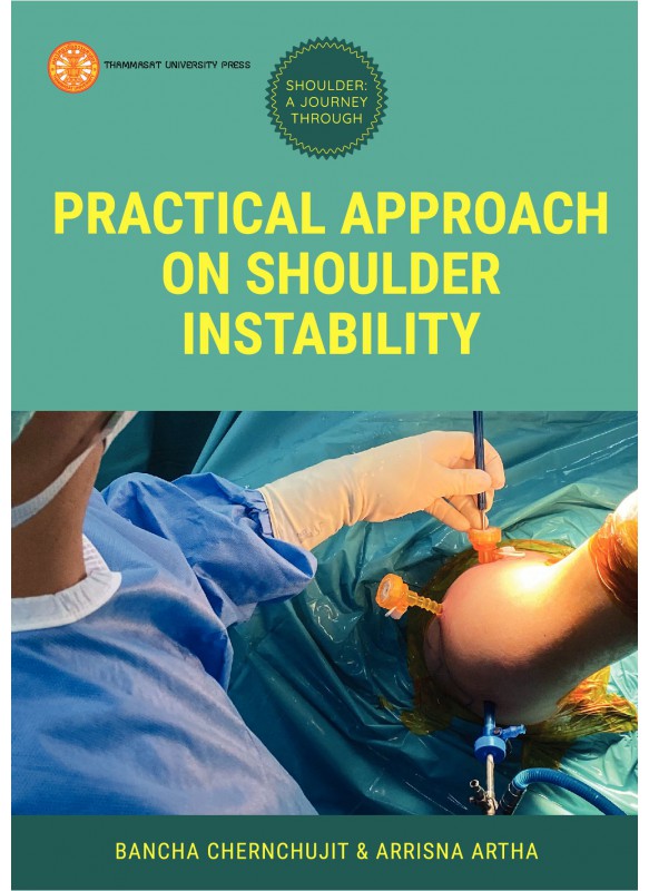 Practical Approach on Shoulder Instability Practical Approach on Shoulder Instability